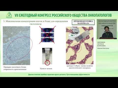 Видео: Диагностические ошибки в практике врача-цитолога. Пути повышения эффективности