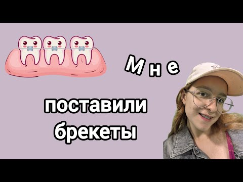 Видео: Мне поставили брекеты // Моя история // Мои впечатления