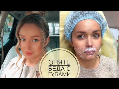 Видео: Еду сдувать губы 👄, полный кошмар