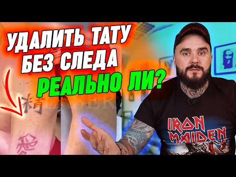 Видео: Удаляем татуировки до БЕЛОЙ КОЖИ! | Можно ли удалить тату за один сеанс? 10 фото лазерного удаления