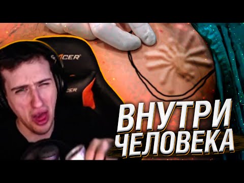 Видео: ОНИ ЖИВУТ ВНУТРИ ЧЕЛОВЕЧЕСКОГО ТЕЛА! // РЕАКЦИЯ HELLYEAHPLAY