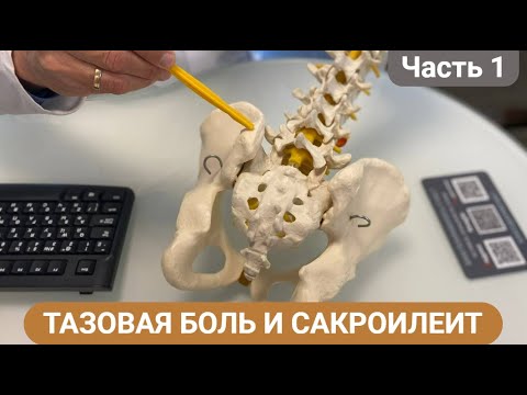 Видео: ПОЧЕМУ БОЛИТ В ОБЛАСТИ ТАЗА? САКРОИЛЕИТ. (Часть 1)