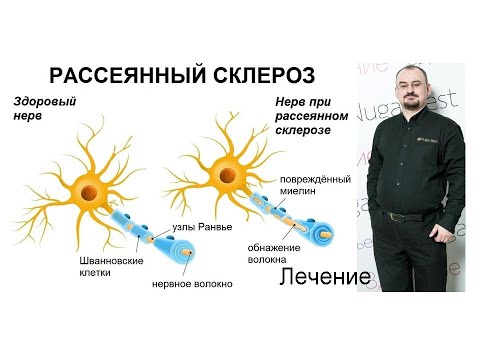 Видео: Рассеянный склероз - лечение.