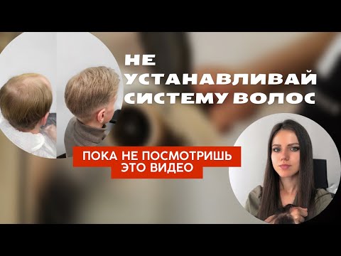 Видео: Система волос для мужчины - как решиться? Что делать, если лысеешь? Могу помочь)