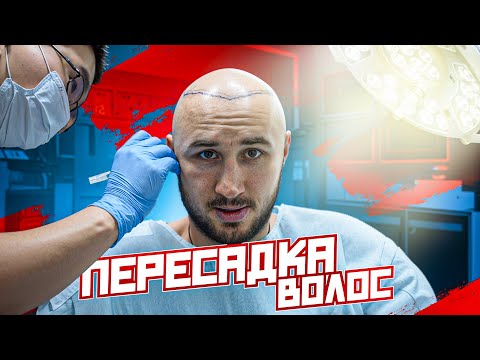 Видео: ПЕРЕСАДКА ВОЛОС ТИМУРУ НИКУЛИНУ