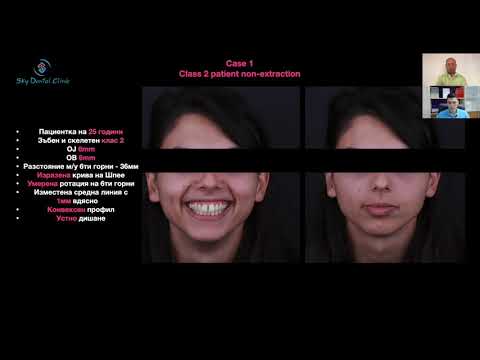 Видео: Последователи на дисциплината "Алекзандър" - епизод 4: д-р Калин Маринов