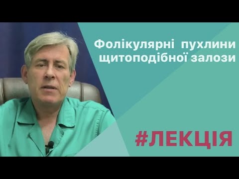 Видео: Фолікулярні пухлини щитоподібної залози