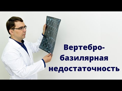 Видео: Вертебро базилярная недостаточность: правда или миф? Все о диагнозе ВБН