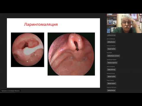 Видео: Хирургия трахеи у детей - Разумовский А.Ю.