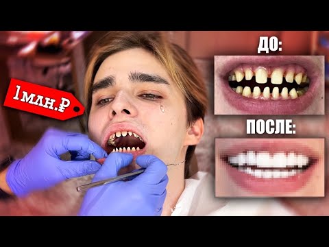 Видео: МОЯ УЛЫБКА ЗА МИЛЛИОН / но есть одно НО…