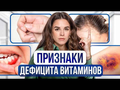 Видео: ОБРАТИ ВНИМАНИЕ! Признаки дефицита витаминов | ТОП 3 витамина обязательных для всех