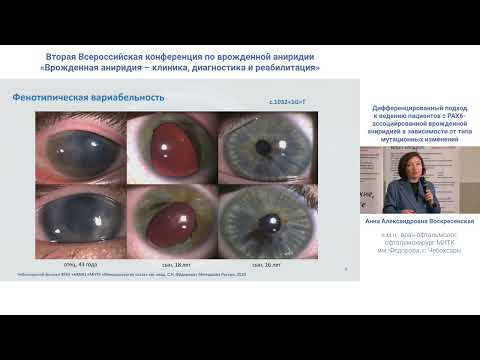 Видео: Дифференциальный подход к ведению пациентов с РАХ6-ассоциированной врожденной аниридией