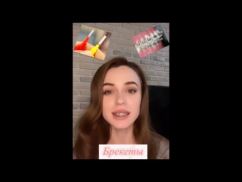 Видео: Брекеты, моя история. Сколько носить, боль, уход, что после снятия?