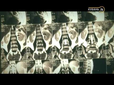 Видео: «Реанимация». Вывих шейного позвонка