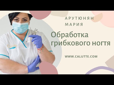 Видео: Обработка грибковых ногтей