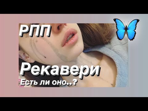 Видео: 3 ШАГА К РЕМИССИИ| КАК Я БОРЮСЬ С РПП| СОВЕТЫ, ПРОВЕРЕННЫЕ НА СЕБЕ