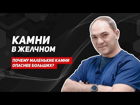 Видео: Желчекаменная болезнь.  Можно ли сохранить желчный?