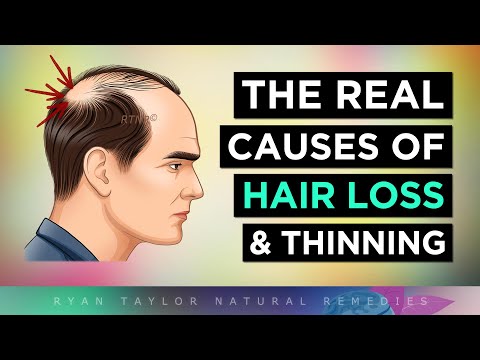Видео: НАСТОЯЩИЕ ПРИЧИНЫ ВЫПАДЕНИЯ ВОЛОС