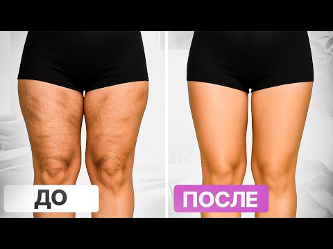 Видео: Как уменьшить ляжки? 3 ЛУЧШИХ упражнения на внутреннюю часть бедра 🔥