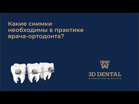 Видео: КЛКТ как основной инструмент в практике ортодонта