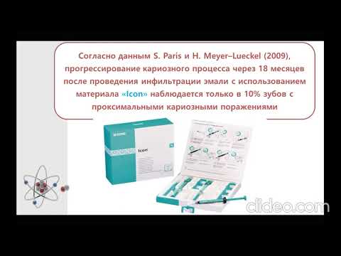 Видео: Методы лечения острого и хронического глубокого кариеса