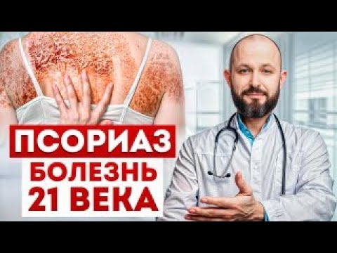 Видео: Как вылечить псориаз с помощью ОДНОЙ свечки? / После ЭТОГО ваша кожа будет ЧИСТОЙ и КРАСИВОЙ!
