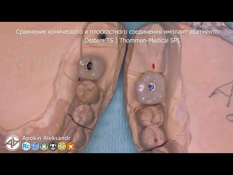 Видео: Сравнение конического и плоскостного соединения имплант-абатмент (Osstem Thommen) 4K