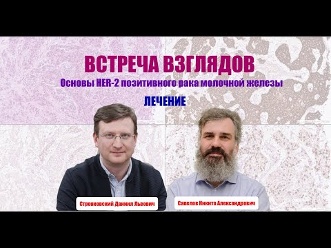 Видео: ВСТРЕЧА ВЗГЛЯДОВ || Лечение HER-2 позитивного рака молочной железы