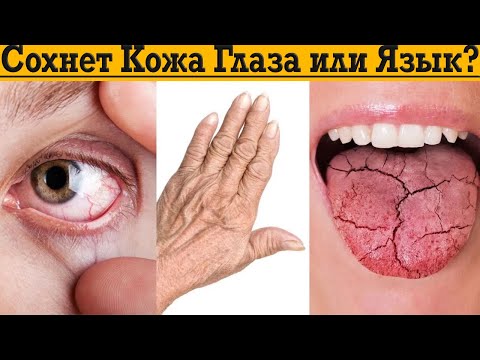 Видео: Сухая кожа, пересыхают глаза, язык или ворту?! Простое решение есть!