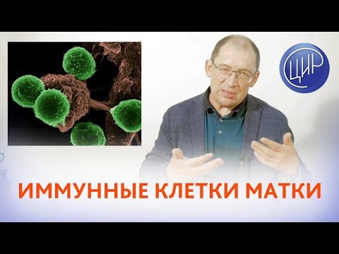 Видео: Хронический эндометрит и иммунные клетки матки. Клетки CD-138, как маркёр хронического эндометрита.