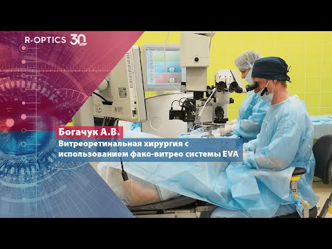 Видео: Витреоретинальная хирургия с использованием фако-витрео системы EVA (Богачук А.В.)