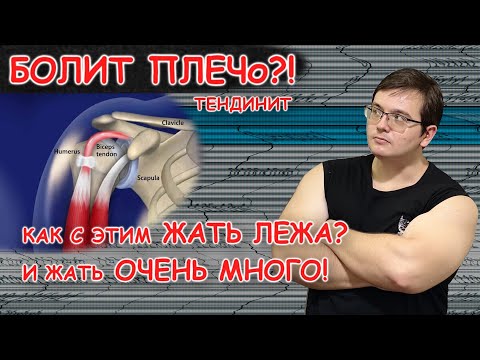 Видео: ЖИМ С БОЛЬНЫМ ПЛЕЧОМ: ЧТО ИЗ ЭТОГО ВЫШЛО. 