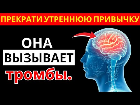 Видео: Врач мозга в шоке: одна привычка ночью разрушает сосуды и вызывает инсульт | здоровье пожилых