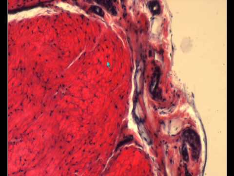 Видео: СУХОЖИЛИЕ В СВЕТОВОЙ МИКРОСКОП. ГИСТОЛОГИЧЕСКОЕ СТРОЕНИЕ