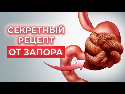 Видео: Как наладить стул? / 2 эффективных упражнения от запора