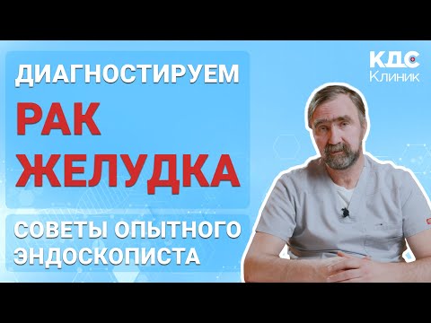 Видео: РАК ЖЕЛУДКА - ДИАГНОСТИКА НА РАННИХ СТАДИЯХ рак желудка