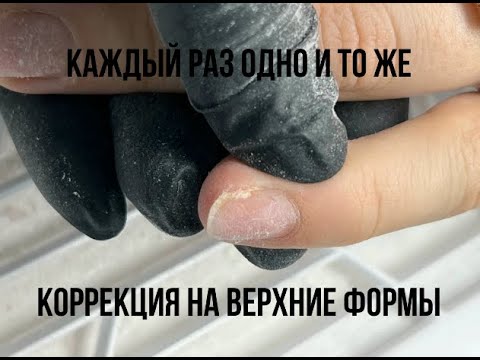 Видео: Где точки вроста?🤨