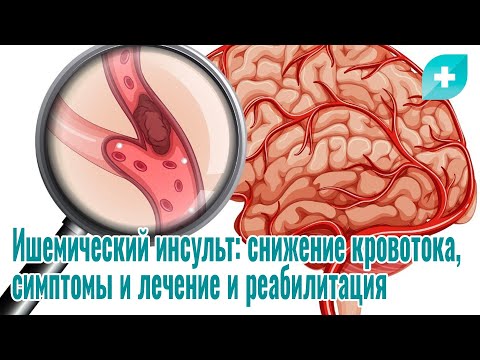 Видео: Ишемический инсульт: снижение кровотока, симптомы и лечение и реабилитация