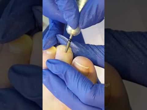 Видео: Наталья Кленина. Педикюр. Влажная и сухая кутикула.