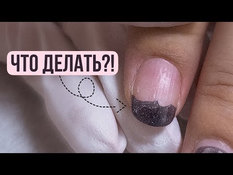 Видео: СКРЫТЫЕ причины отслоек гель лака! ❌ НЕ ДЕРЖИТСЯ ГЕЛЬ ЛАК! Маникюр подписчице 💟 ОТСЛОЙКИ У КУТИКУЛЫ