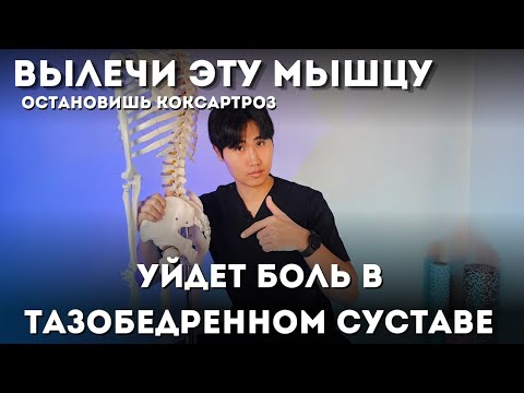 Видео: Вылечи эту мышцу, уйдет боль в тазобедренном суставе, остановишь коксартроз