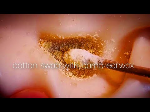 Видео: АSMR Звук ватного тампона, смоченного влажной ушной серой!! Расслабляющий чистка ушей❤️ (No talking)