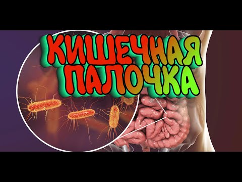 Видео: Как пережить ДЕРЬМОВЫЙ АПОКАЛИПСИС  - 4: Эшрихия коли. Кишечная палочка. когда друг стал врагом.