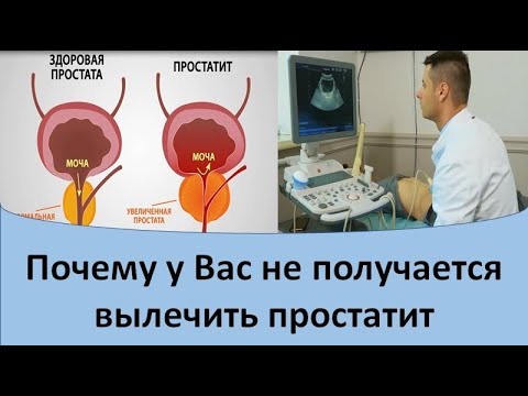 Видео: Простатит лечение. Почему у Вас не получается вылечить простатит.