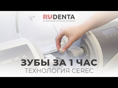 Видео: Коронка за 1 час? ЭТО РЕАЛЬНО! Новинка в Рудента: технология CEREC