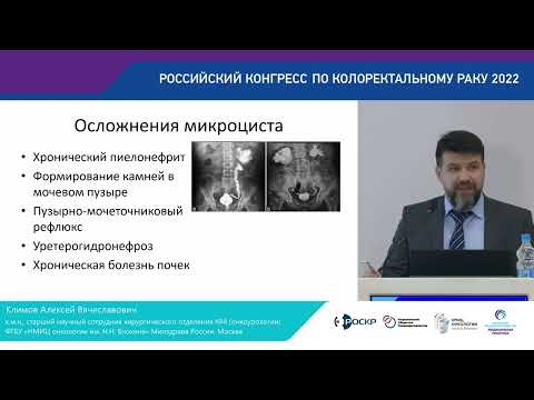 Видео: МИКРОЦИСТ ИЛИ ЦИСТЭКТОМИЯ  ПОСЛЕДСТВИЯ ОБШИРНЫХ РЕЗЕКЦИЙ МОЧЕВОГО ПУЗЫРЯ