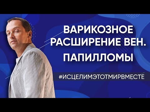 Видео: Варикозное расширение вен / Папилломы / Предназначение / Часто болеет ребенок / Финансовые проблемы