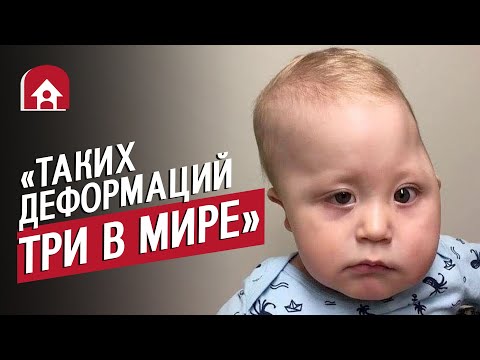 Видео: У моего сына деформация черепа: Таня | Быть мамой