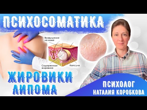 Видео: Жировики Липома Психосоматика