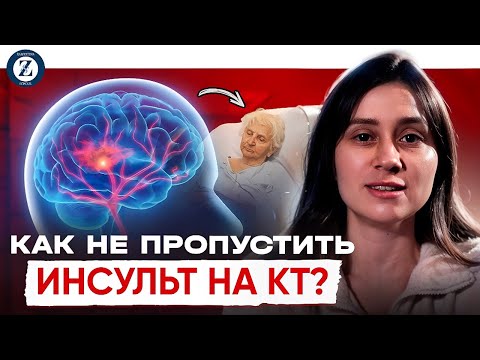 Видео: КАК НЕ ПРОПУСТИТЬ ИНСУЛЬТ ГМ НА КТ? Замятина Ксения Андреевна